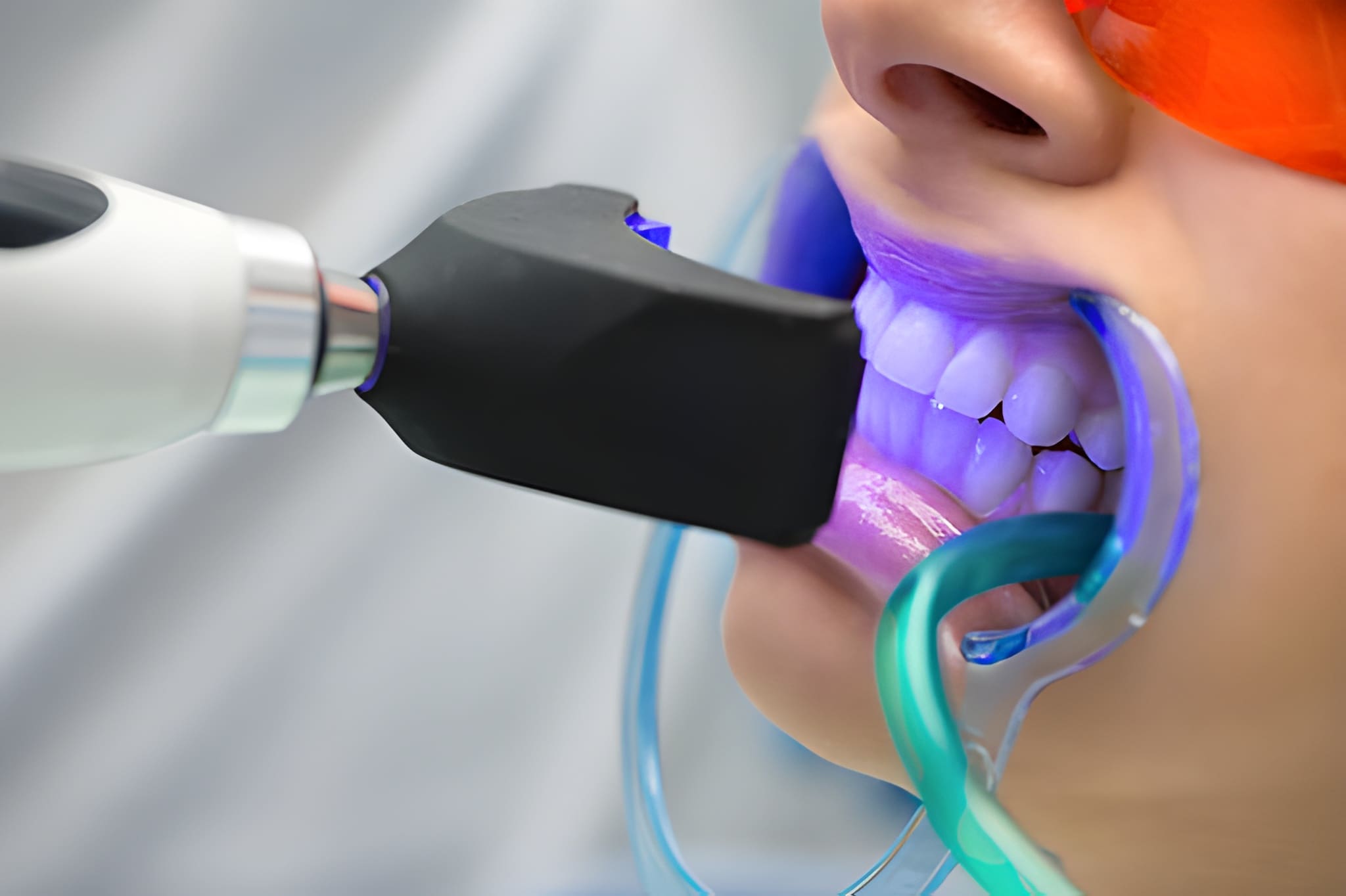 Why Garland Patients Choose North Texas Family & Cosmetic Dentistry for Teeth Whitening_FI